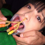 【柴森ゆうひ】スクールビキニ姿のドMマゾロリ女子校生を拘束電動オモチャ電マ責め手マンオナニーイラマチオ喉奥拷問SM調教えろ動画